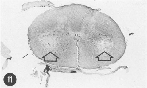 Fig. 11.