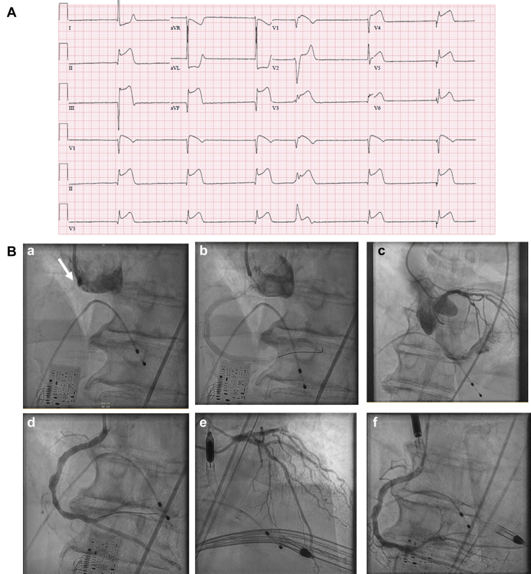 Figure 1