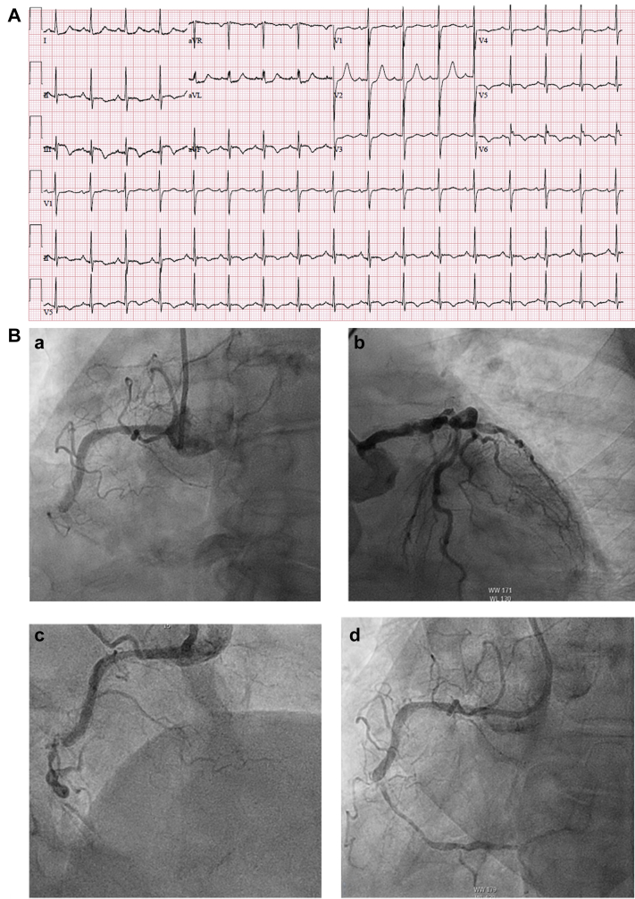 Figure 2