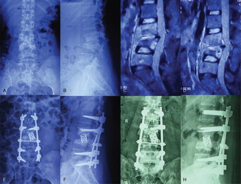 FIGURE 2