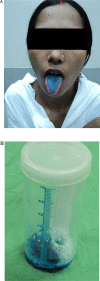 Figure 11