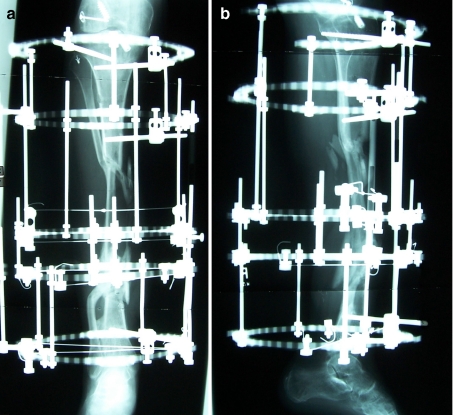 Fig. 3