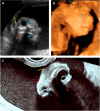 Fig. 3