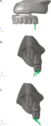 Fig. 2