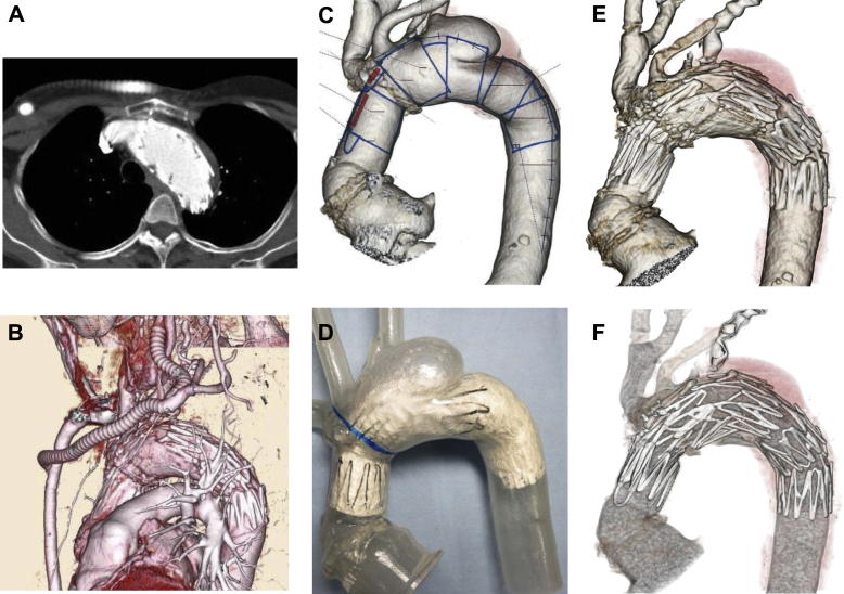 Fig 3