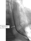 Fig. 2-3