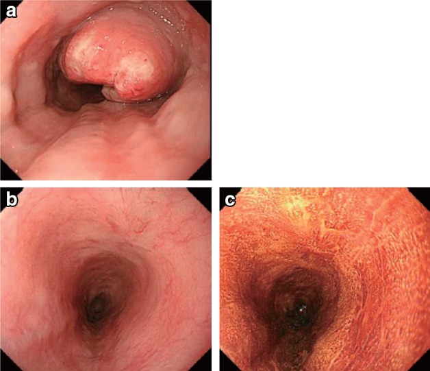 Fig. 3-3