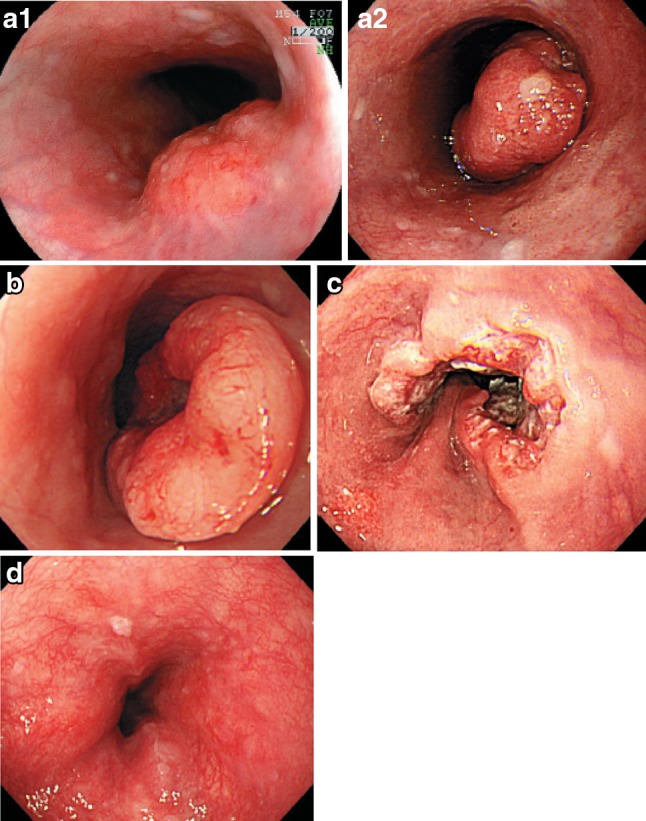 Fig. 2-10