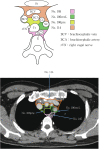 Fig. 2-17