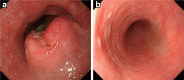 Fig. 3-2