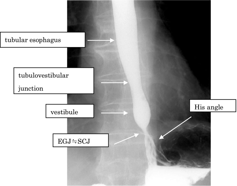 Fig. 2-2