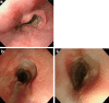Fig. 3-5