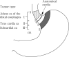 Fig. 2-6