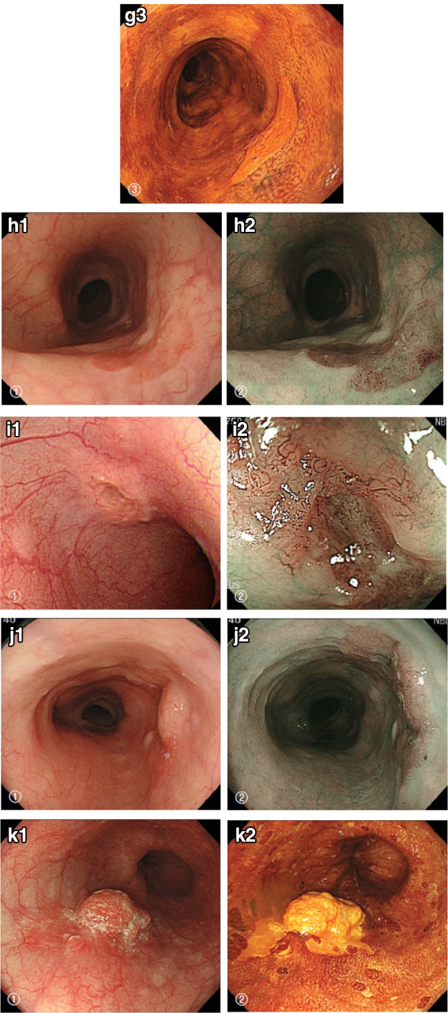 Fig. 2-13