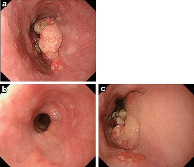 Fig. 3-9