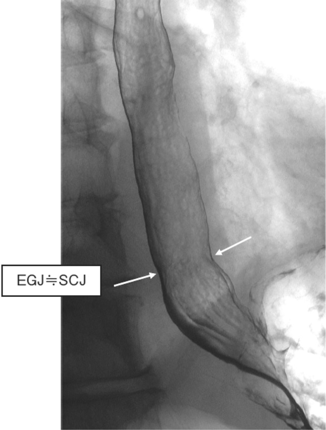 Fig. 2-3