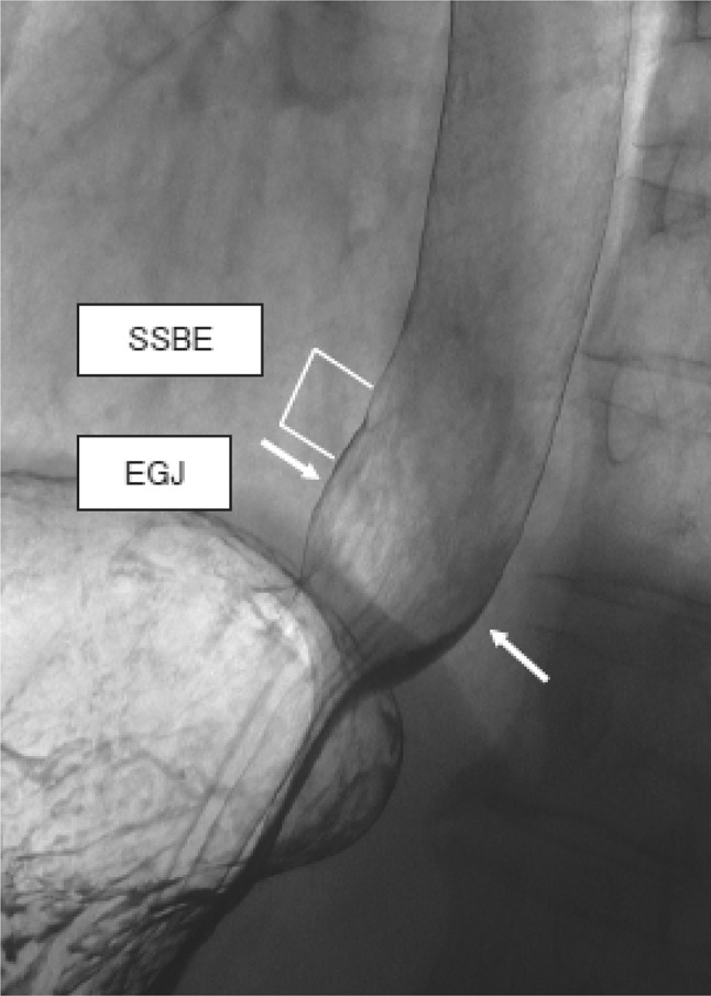 Fig. 2-4