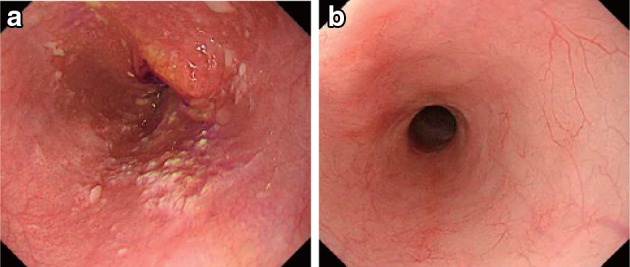 Fig. 3-1