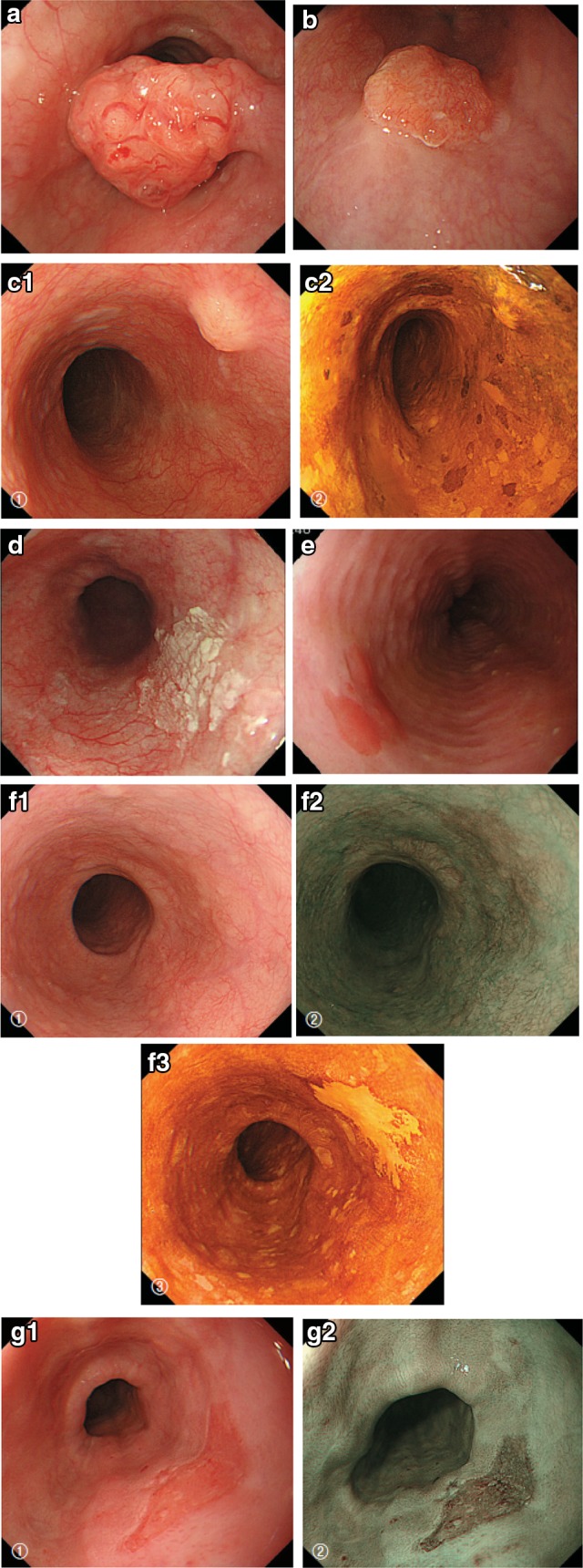 Fig. 2-13