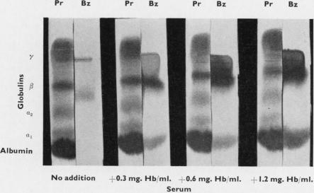 graphic file with name jclinpath00044-0017-b.jpg