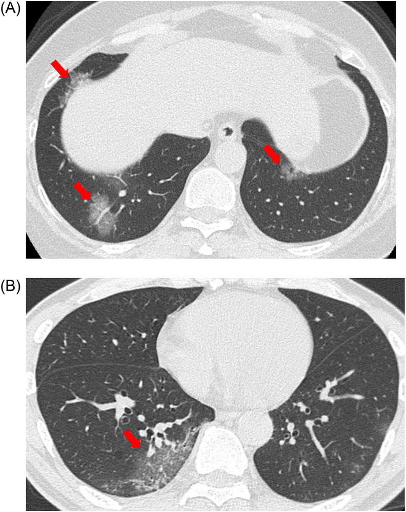 Fig. 3