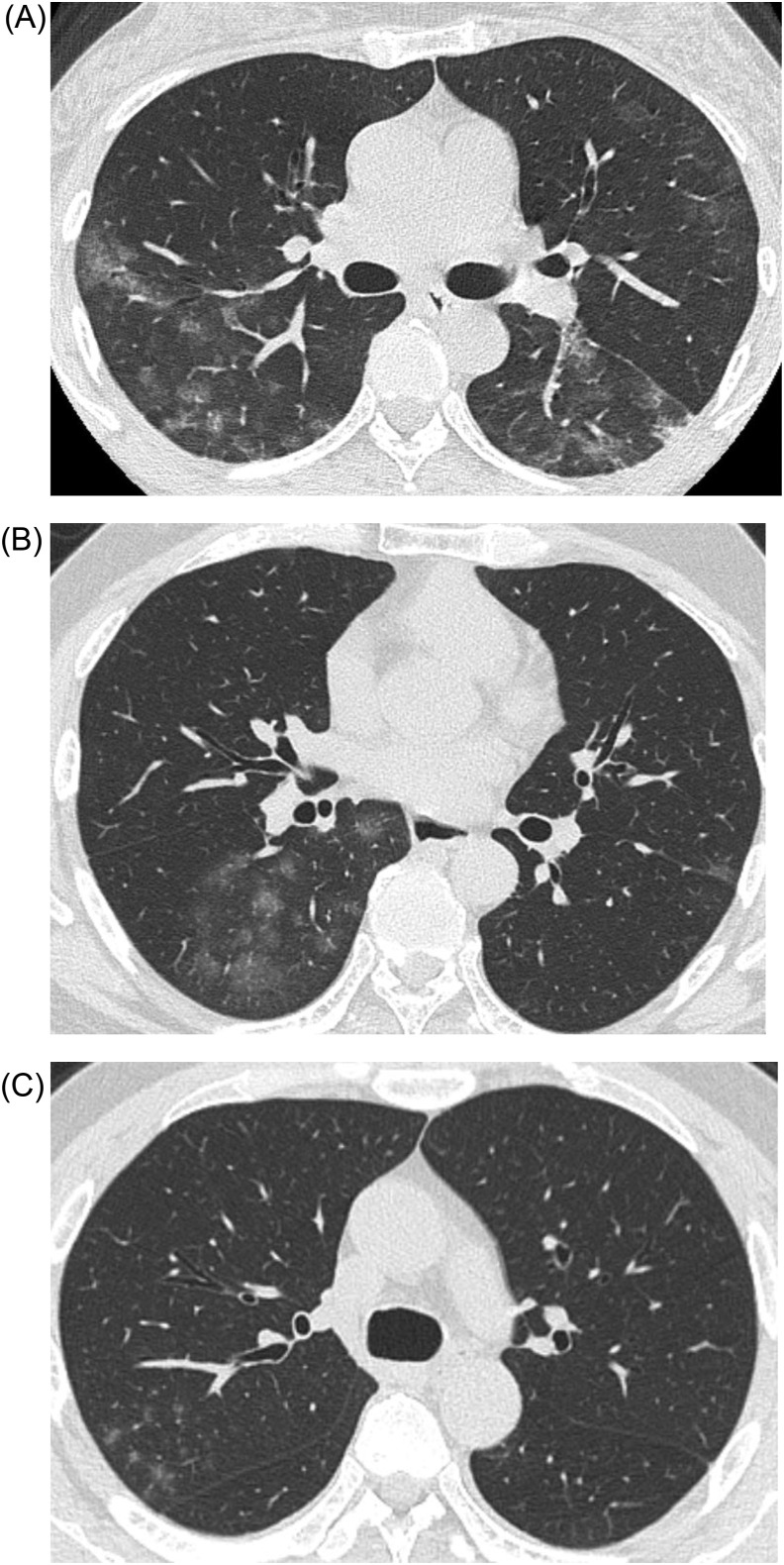 Fig. 2