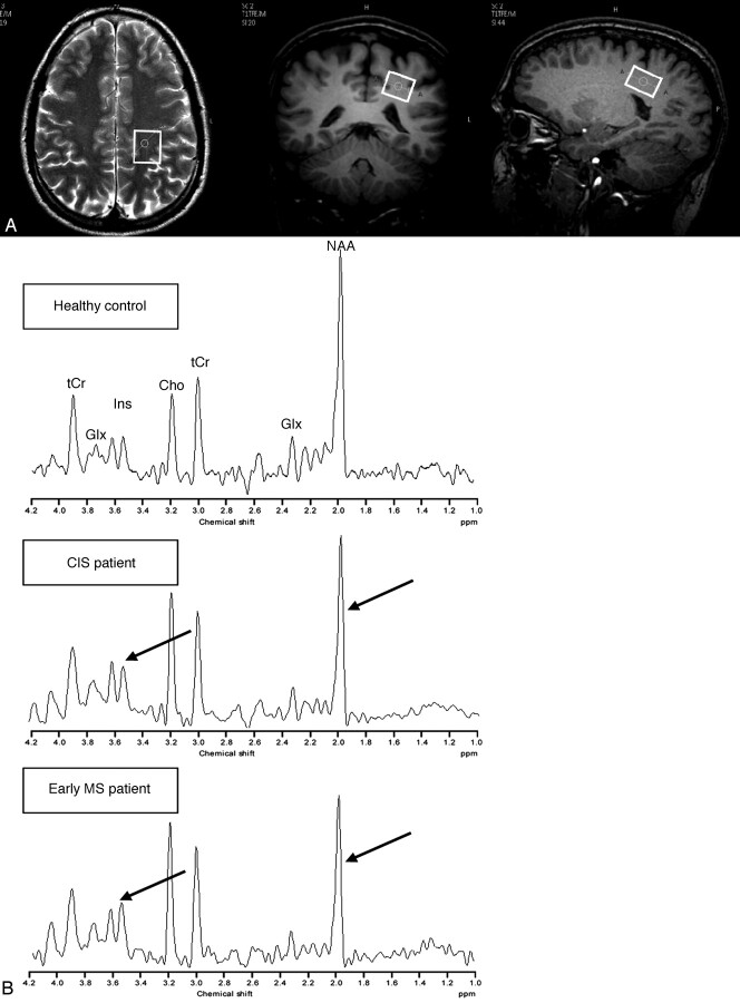 Fig 1.