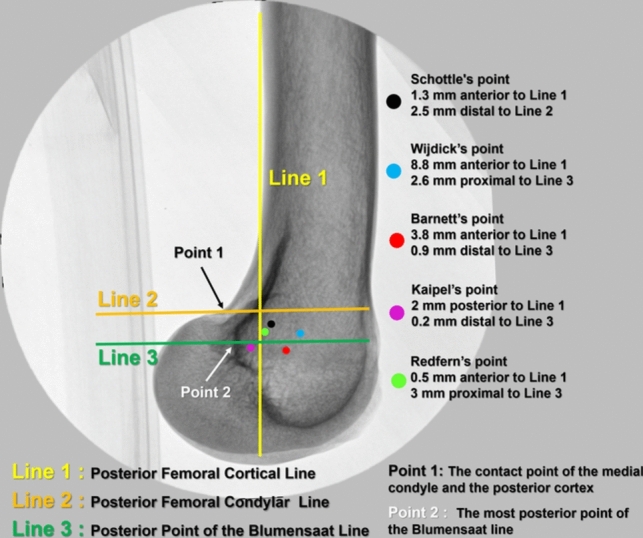 Fig. 1