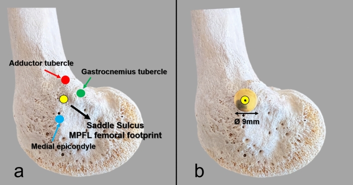 Fig. 2