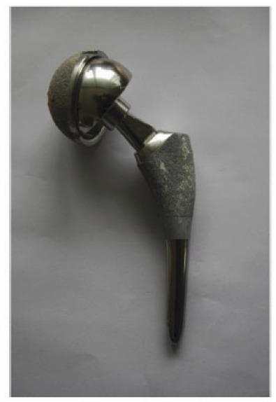 Fig. (1)