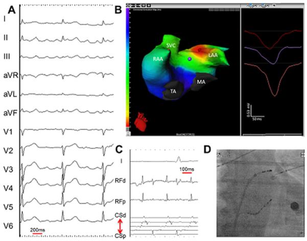 Figure 14