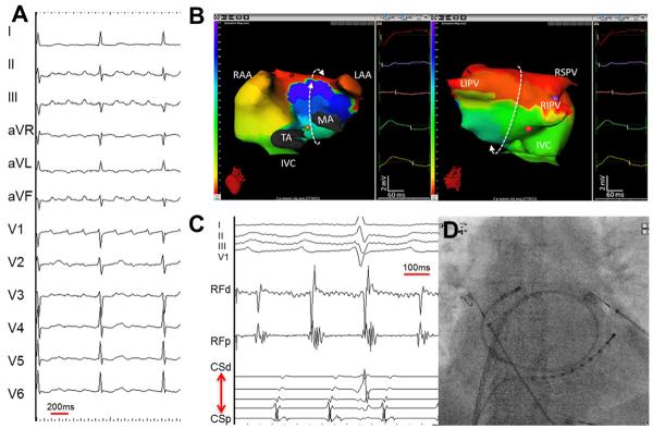 Figure 17