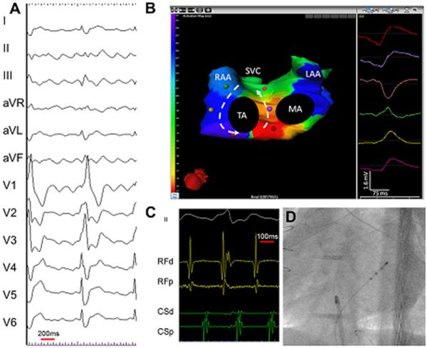 Figure 15