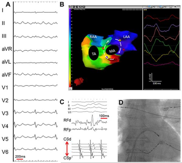 Figure 16