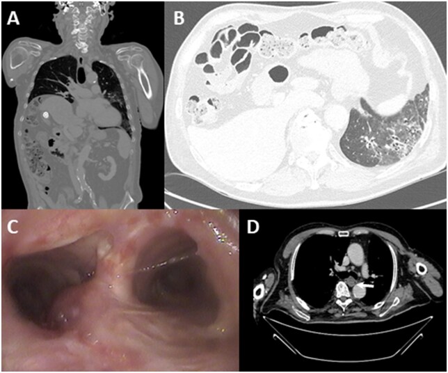 Figure 1: