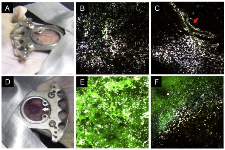 Figure 13