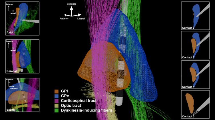 Fig. 2