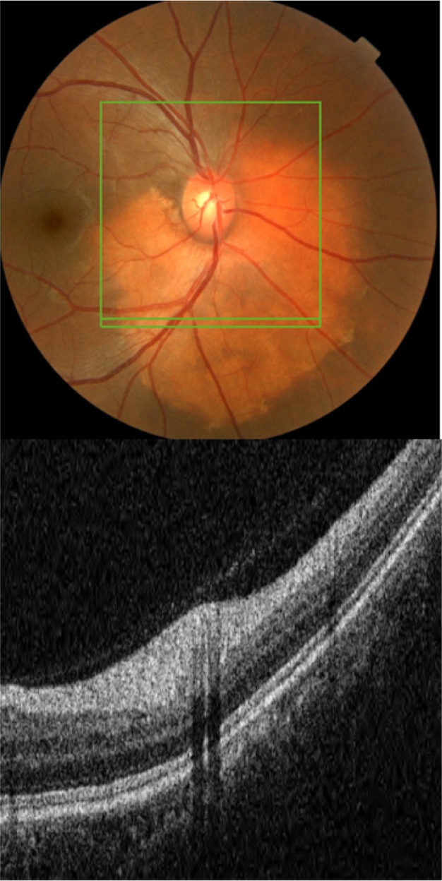 Figure 22