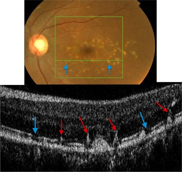 Figure 16