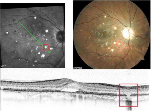 Figure 19