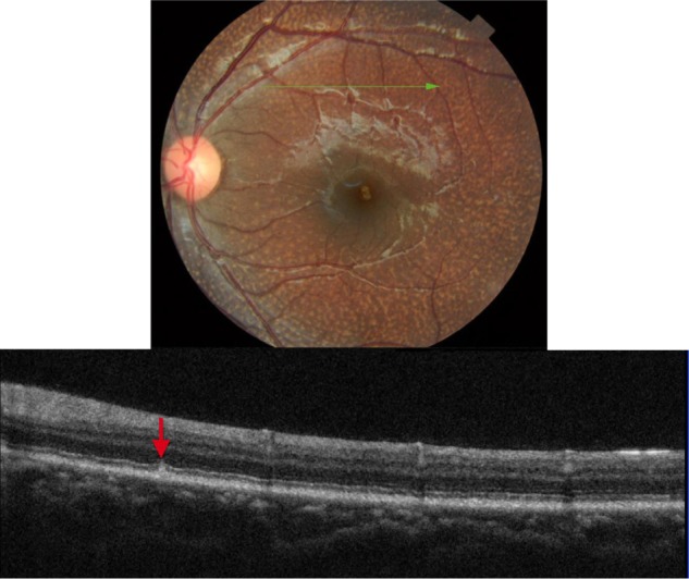 Figure 15