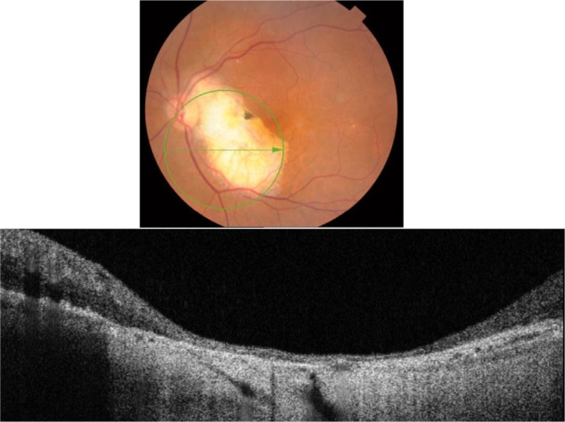 Figure 21