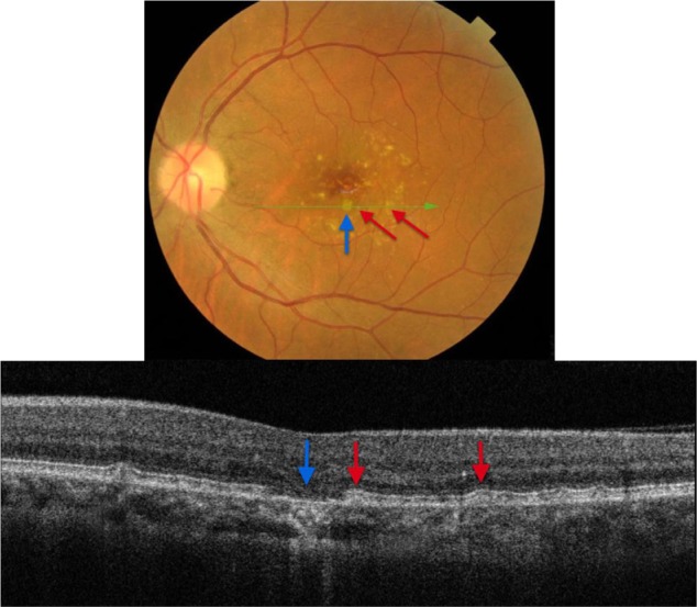 Figure 13