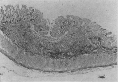 Fig. 11