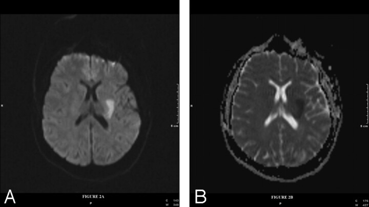 Fig 2.