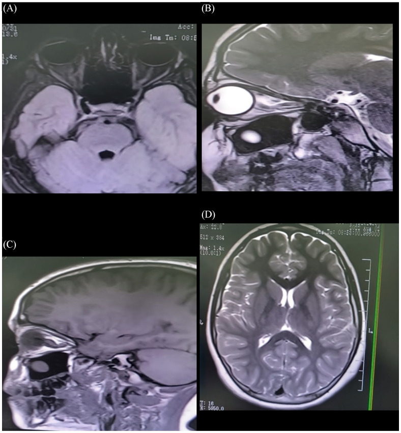 Figure 2.