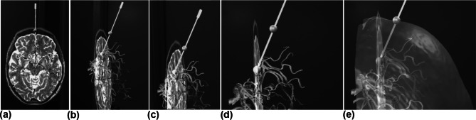 Fig. 5