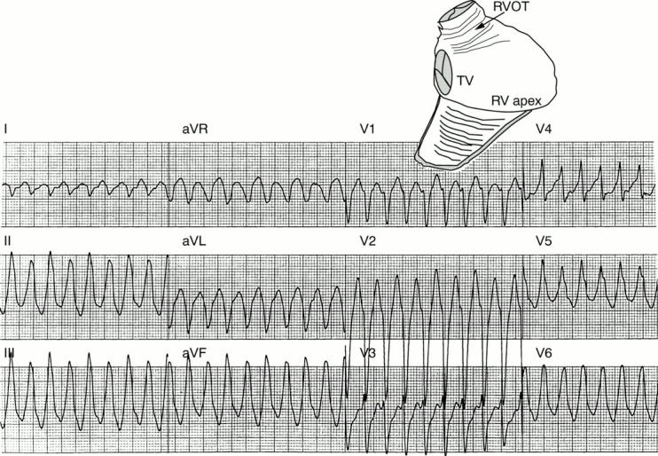 Figure 1:  