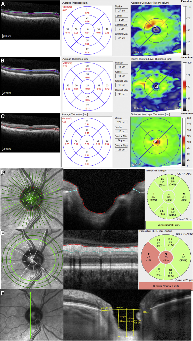 Fig. 1