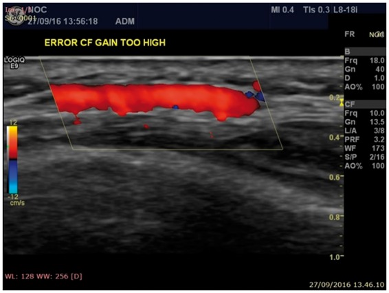 Fig. 3